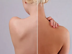 Samoopalacze: co robić, a czego unikać? Samoopalacze: co robić, a czego unikać?